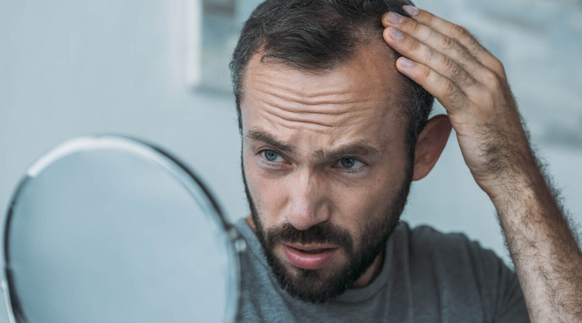 Homem preocupado com a queda de cabelo, olhando para o espelho e verificando sinais de calvície, representando preocupação com a saúde capilar.