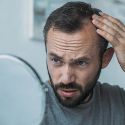 Homem preocupado com a queda de cabelo, olhando para o espelho e verificando sinais de calvície, representando preocupação com a saúde capilar.